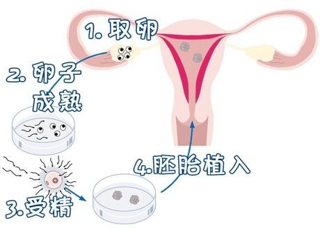 冷冻室
